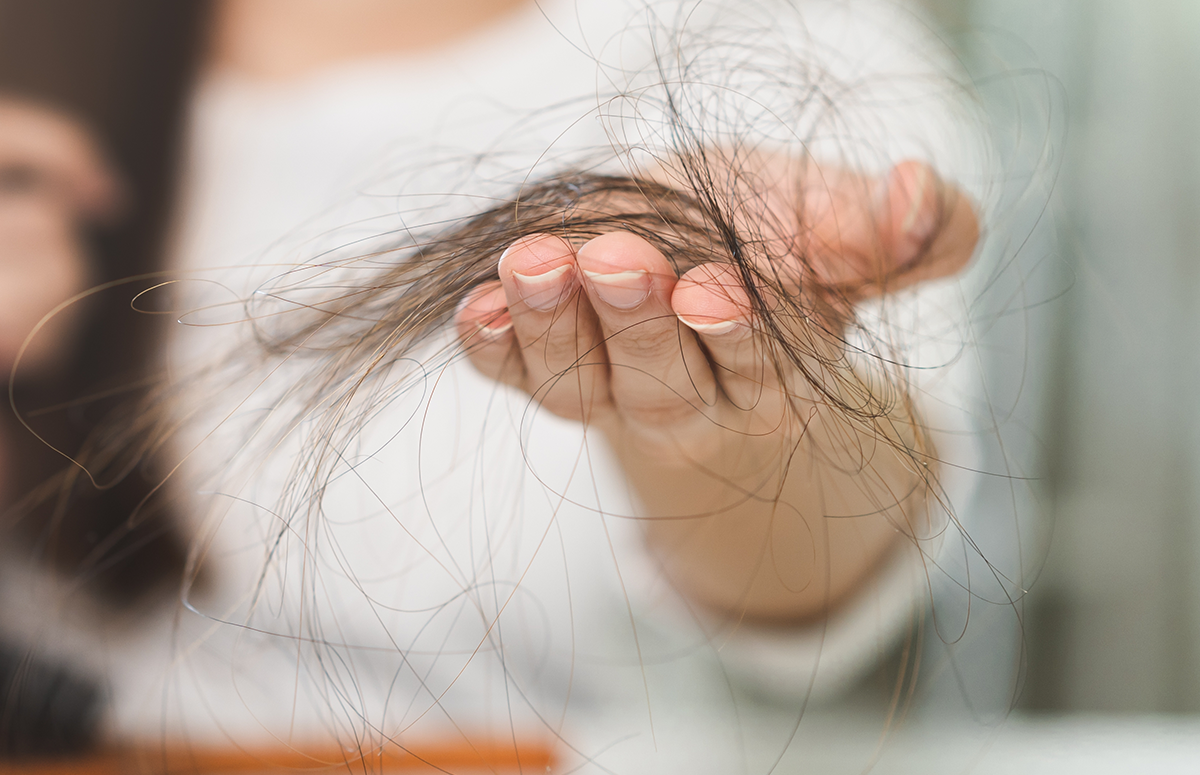 En person som håller i massa hår som har fallit från huvudet